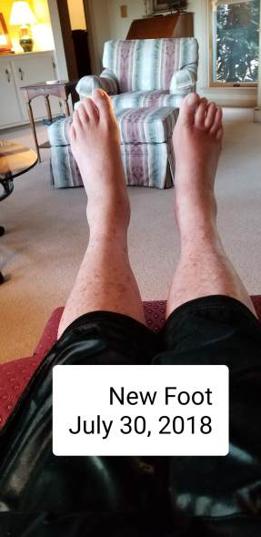 New Foot